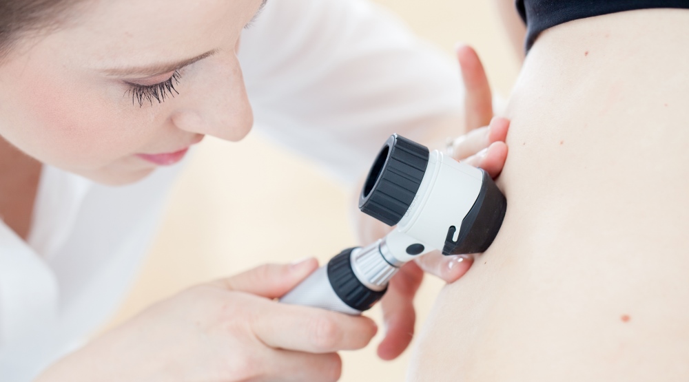 Skin cancer removal tops dermatologists’ treatment list