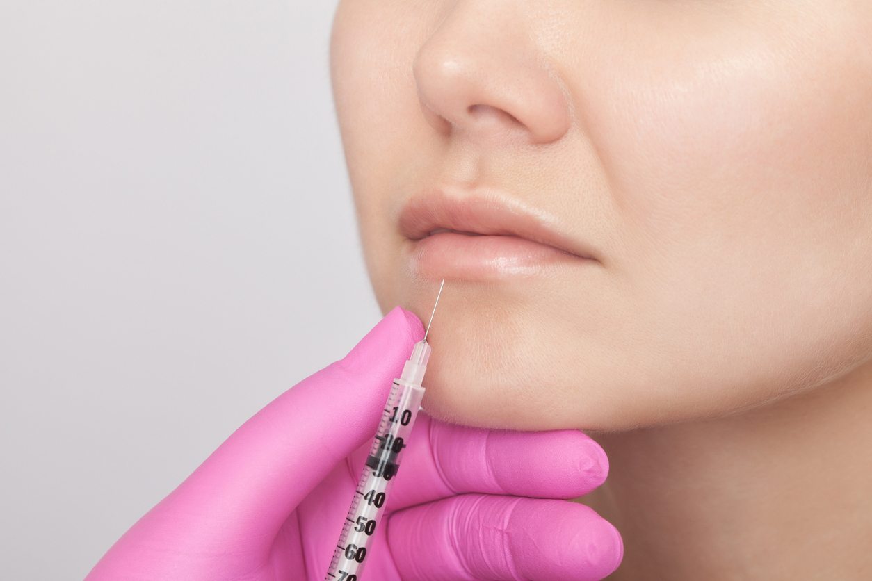 Lip filler market continues growth