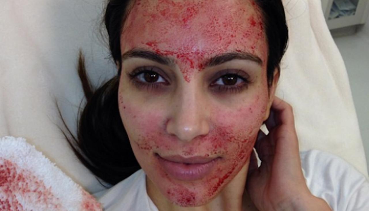 Kim Kardashian West sues cosmetic surgeon