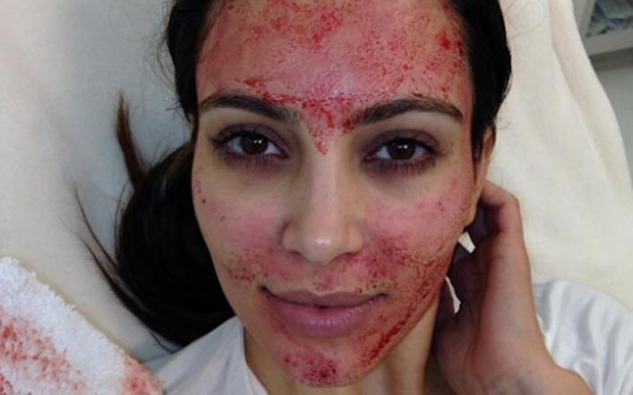 Kim Kardashian West sues cosmetic surgeon