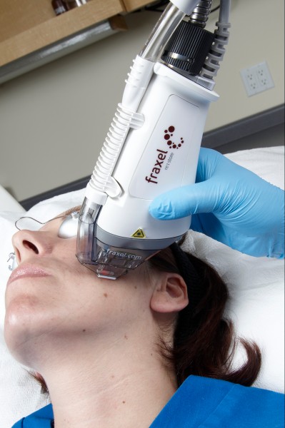 Here’s How Fraxel Laser Technology Can Safely Treat All Skin Types With Maximal Results