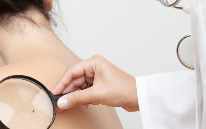 We are one step closer to a skin cancer vaccine