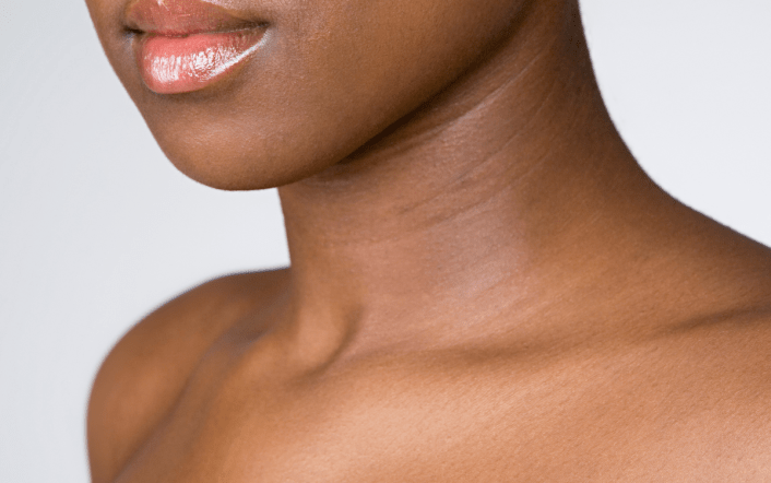 Caci Extends Profhilo Offering to Décolletage and Hands
